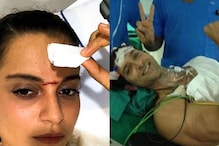 From Hrithik Roshan's Brain Clot to Kangana Ranaut's Forehead Cut: Actors Injured on Sets | Throwback