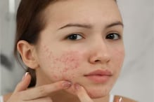 The Impact of Climate Change on Skin: Insights from Leading Cosmetologists