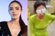 Jasmin Bhasin Is 'Feeling Worst' Due To Corneal Damage, Talks About 'Excruciating Pain and No Vision'